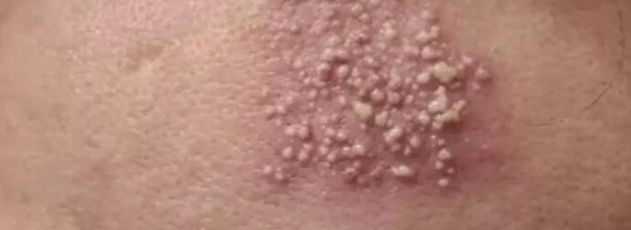 Αυτές είναι οι συνέπειες του να κοιμάσαι με…