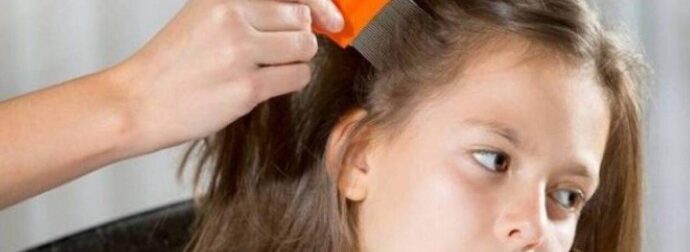 Τραγωδία σοκ-Πάγωσαν με το θέαμα οι αστυνομικοί: Νεκρή 12χρονη από ψείρες στο κεφάλι, της ήπιαν όλο το αίμα-Συνελήφθησαν οι γονείς