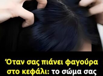 Όταν σας πιάνει φαγούρα στο κεφάλι: το σώμα σας προσπαθεί να σας στείλει ένα μήνυμα
