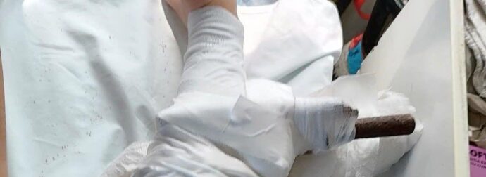 Δεύτερο περιστατικό μέσα σε λίγες εβδομάδες: Ομπρέλα καρφώθηκε στο πόδι 26χρονης – Μεταφέρθηκε στο νοσοκομείο