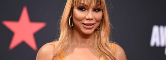 Έκτακτο για πασίγνωστη 48χρονη τραγουδίστρια – Την βρήκαν σε λίμνη αίματος, χωρίς δόντια με χτύπημα στο πρόσωπο