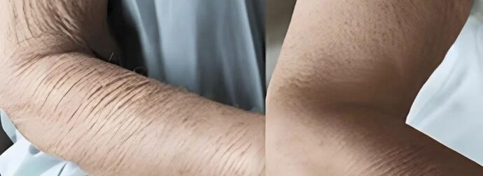 Πώς να φροντίσετε το δέρμα που γερνάει