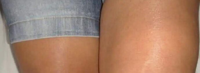 Αν δείτε ένα πόδι πρησμένο, είναι σημάδι…