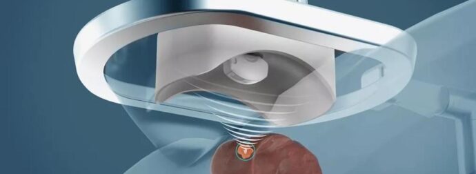 Ρομπότ στις ΗΠΑ καταστρέφει τον καρκίνο με υπέρηχο – Η θεραπεία γίνεται χωρίς κανένα άνοιγμα του κορμιού