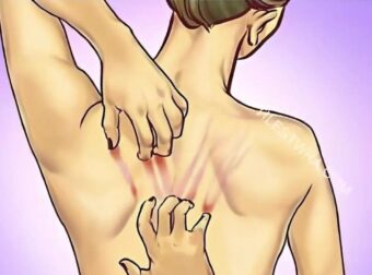 Αν τα νεφρά σας βρίσκονται σε κίνδυνο το σώμα σας θα εμφάνισε αυτά τα 10 σημάδια