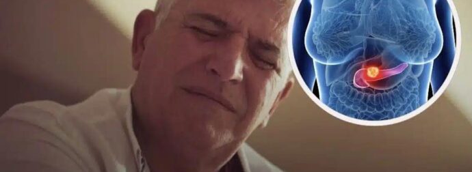 Καρκίνος παγκρέατος: Δύο πρώιμα σημάδια ενός συχνά θανατηφόρου καρκίνου