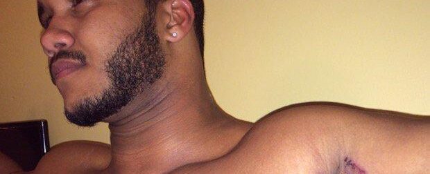 Όπως έκανε μπάνιο ένιωσε κάτι να τον καίει κάτω από τη μασχάλη: Δεν ήταν το σαπούνι αλλά κάτι ΧΕΙΡΟΤΕΡΟ