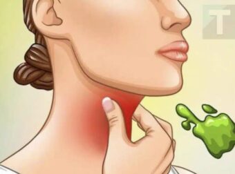 Οι πραγματικές αιτίες του συνεχούς φλέγματος στο λαιμό και πώς να απαλλαγείτε από αυτό