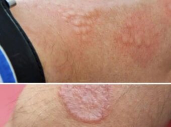 Αυτά είναι τα σημάδια ότι είναι…