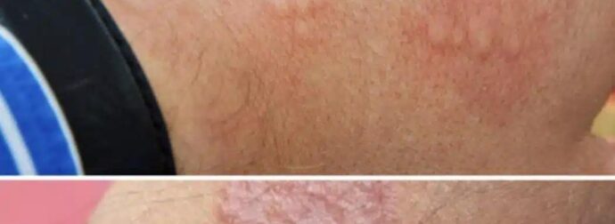 Αυτά είναι τα σημάδια ότι είναι…