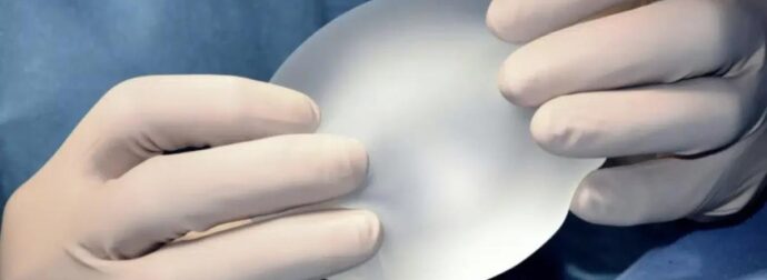 30χρονη Ελληνίδα μητέρα πήγε σε πασίγνωστο πλαστικό στην Αθήνα να φτιάξει το στήθος της και της το έκανε τετράγωνο