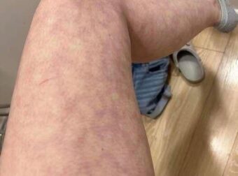 Αυτές είναι οι συνέπειες να κοιμάσαι με..