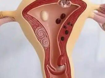 Έτσι αντιδρά το σώμα όταν…