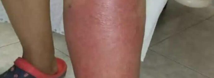 Αυτά Είναι Ξεκάθαρα Σημάδια Ότι Είναι