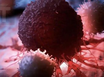 8 από τις καλύτερες αντικαρκινικές τροφές. Ήρθε η ώρα να τις προσθέσετε στη διατροφή σας