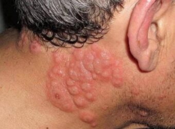 Γιατί πολλοί ειδικοί συμβουλεύουν να μην κοιμόμαστε με ανοιχτό παράθυρο