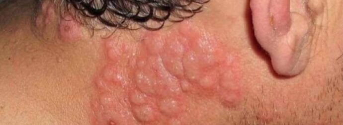 Γιατί πολλοί ειδικοί συμβουλεύουν να μην κοιμόμαστε με ανοιχτό παράθυρο