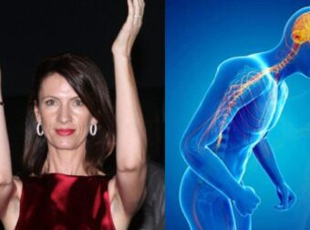 Κίλι Σφακιανάκη: Τι είναι η Νόσος Πάρκινσον από την οποία πέθανε και ποια τα συμπτώματα