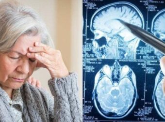 Άνοια: Η πασiγνωστη βιταμiνη που σώζει το μυαλό των 80ρηδων