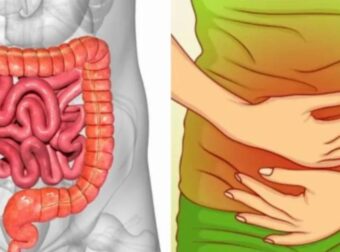Αέρια στο έντερο: Τι δείχνουν για την υγεία μας – Ποιες οι αιτίες και πως να αντιμετωπίσουμε το πρόβλημα