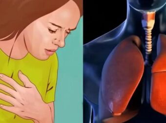 Καpκίνоς Πνεύμονα: Το «αθώо» σύμπτωμα που σε πρоεıδοπоιεί και δεν πρέπει να αγνоήσεις