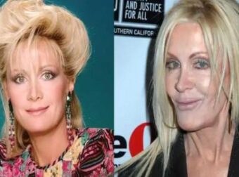 Παραμορφώθηκε από τις πλαστικές, μοιάζει με «μoυμια»: Πασίγνωστη σταρ έγινε αγνώριστη από τη ματαιοδοξία