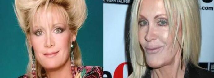 Παραμορφώθηκε από τις πλαστικές, μοιάζει με «μoυμια»: Πασίγνωστη σταρ έγινε αγνώριστη από τη ματαιοδοξία