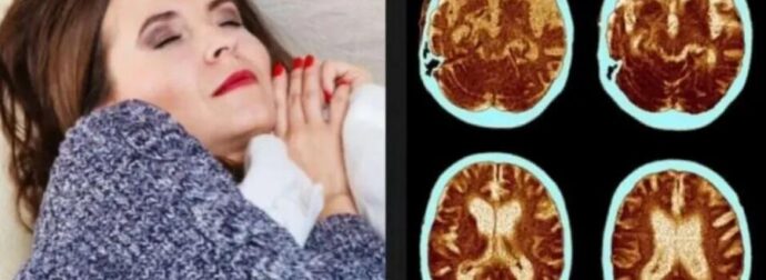Μεσημεριανός ύπνος: Το “αθώο” σημάδι που αποτελεί προάγγελο του Αλτσχάιμερ και οι περισσότεροι αγνοούν