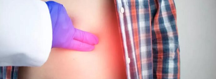 Σημάδια καρκίνου του παχέος εντέρου: Τα συμπτώματα που δεν πρέπει να αγνοήσετε