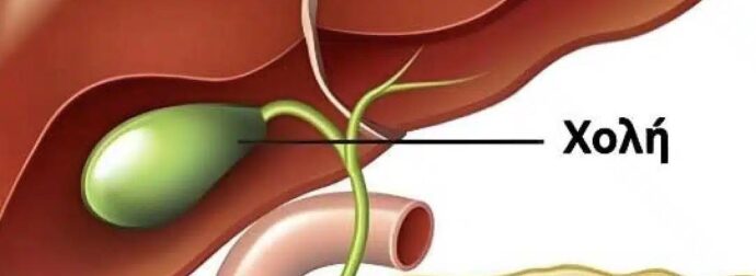 Τι συμβαίνει στο σώμα μετά την αφαίρεση της χοληδόχου κύστης; 3 ασθένειες που μπορεί να ακολουθήσουν – Αποφύγετε τη χειρουργική επέμβαση εάν είναι δυνατόν