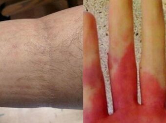 Ανακοπή καρδιάς: 6 προειδοποιητικά σημάδια που θα νιώσετε λίγες μέρες πριν