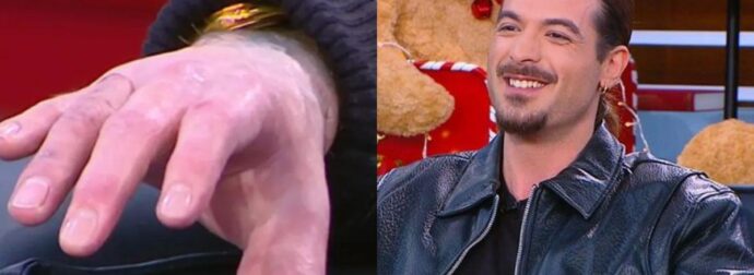 «Το χαϊδέψανε και μου είπανε “μπαμπά, το μιμί πέρασε”»: Ο Άρης Μουγκοπέτρος έδειξε στο «Πρωινό» τα πρόσθετα δάχτυλά του