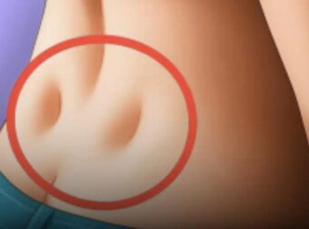 Έχετε αυτά τα δύο μικρά λακκάκια στη βάση της πλάτης σας; Τι αποκαλύπτουν