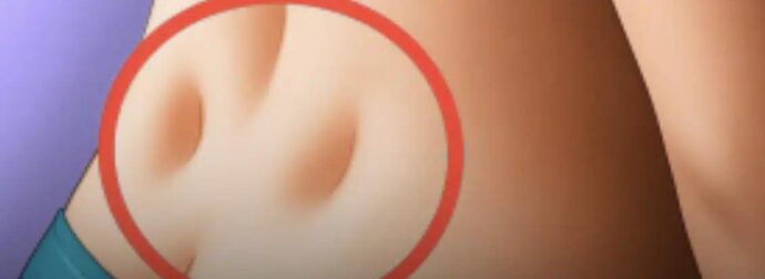 Έχετε αυτά τα δύο μικρά λακκάκια στη βάση της πλάτης σας; Τι αποκαλύπτουν