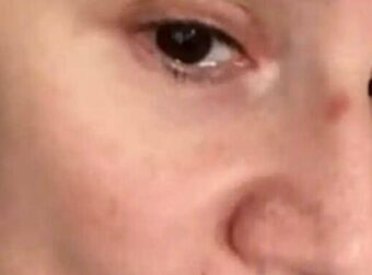 Δύσκολες ώρες για την Ελληνίδα ηθοποιό Πέγκυ Τρικαλιώτη