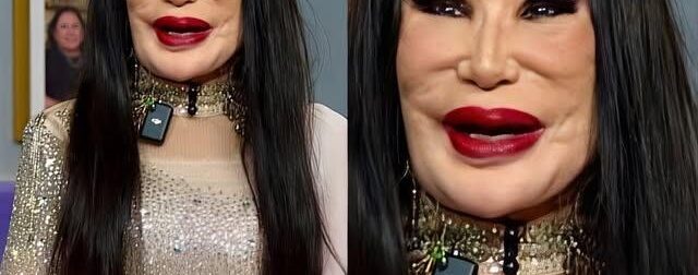 Ήταν μια διάσημη ηθοποιός που εμφανίστηκε σε περίπου 100 ταινίες, αλλά ένα τραγικό λάθος άλλαξε άρδην την εμφάνισή της