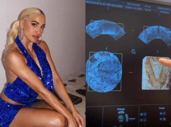 Η Ιωάννα Τούνη το τερμάτισε: Πήρε τους φίλους της στα social ακόμη και στην γυναικολόγο για να αποκαλύψει ότι έχει βάλει σπιράλ