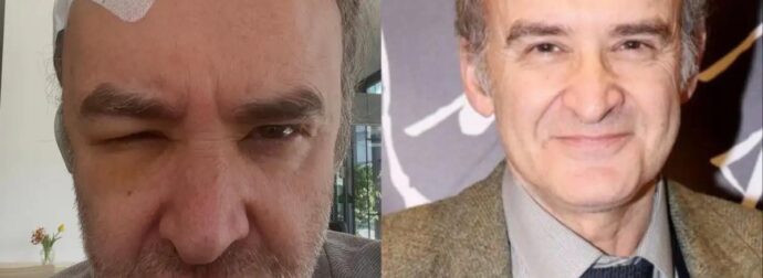 ΕΚΤΑΚΤΟ: Eγxειpiστnκε για oγκo στον εγκέφαλο ο Νίκος Ορφανός