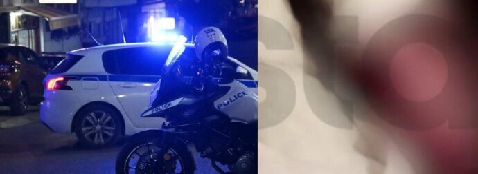 EKTAKTO ΤΩΡΑ: Γιος πασίγνωστού Έλληνα ποινικολόγου, έπεσε θύμα άγριου ξυλοδαρμού – ΣΟΚ ποιός είναι