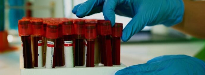 Νίκος Σύψας για χανταϊό: «Έχουμε συρροή κρουσμάτων»- Σε ποιες περιπτώσεις συνιστά να φοράμε μάσκα