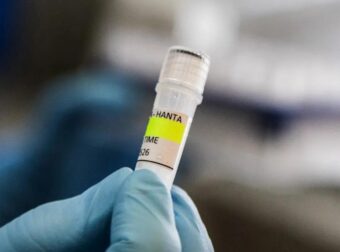 EXOYME TON ΠΡΩΤΟ ΝΕΚΡΟ ΑΠΟ ΧΑΝΤΑΙΟ – ΔΕΝ ΘΑ ΠΙΣΤΕΥΕΤΕ ΠΟΙΟΣ ΕΙΝΑΙ
