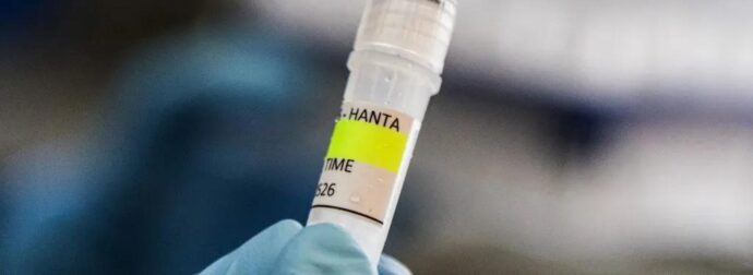 EXOYME TON ΠΡΩΤΟ ΝΕΚΡΟ ΑΠΟ ΧΑΝΤΑΙΟ – ΔΕΝ ΘΑ ΠΙΣΤΕΥΕΤΕ ΠΟΙΟΣ ΕΙΝΑΙ