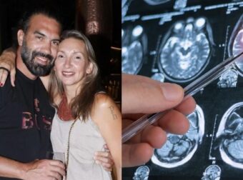 Τι είναι η ρήξη ανευρύσματος που υπέστη ο σύζυγος της Φανής Χαλκιά; Τα συμπτώματα που δεν πρέπει ποτέ να αγνοήσετε