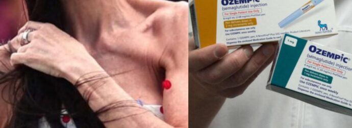 Αυτό που κανείς δεν λέει για το Ozempic: Τι συμβαίνει όταν κόβεις τις ενέσεις