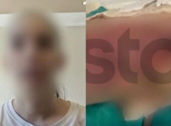 Συγκλονίζει η γυμνάστρια στην Θεσσαλονίκη: «Είχα γαντζωθεί στο κρεβάτι, έβραζαν τα πόδια μου», καταγγέλλει η 20χρονη, δείτε βίντεο